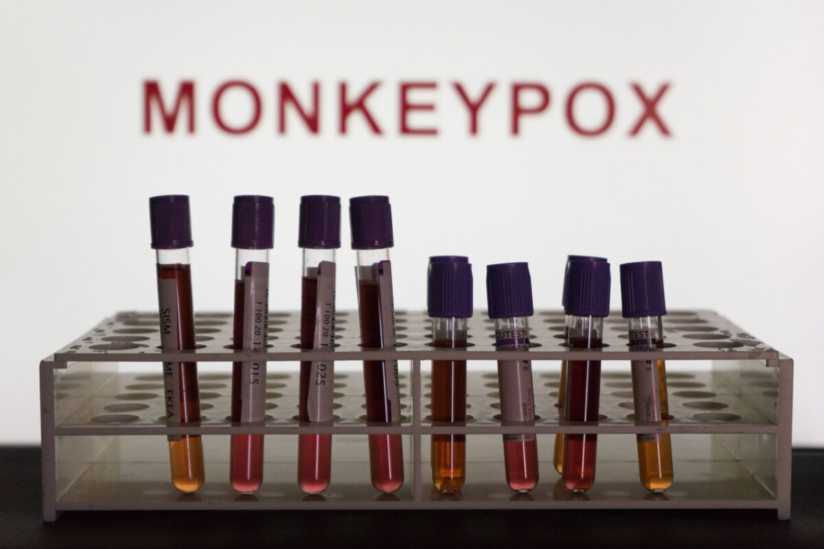 NYC Will No Longer Refer To Virus As Monkeypox To Avoid ‘Inaccurate And Stigmatizing Label’