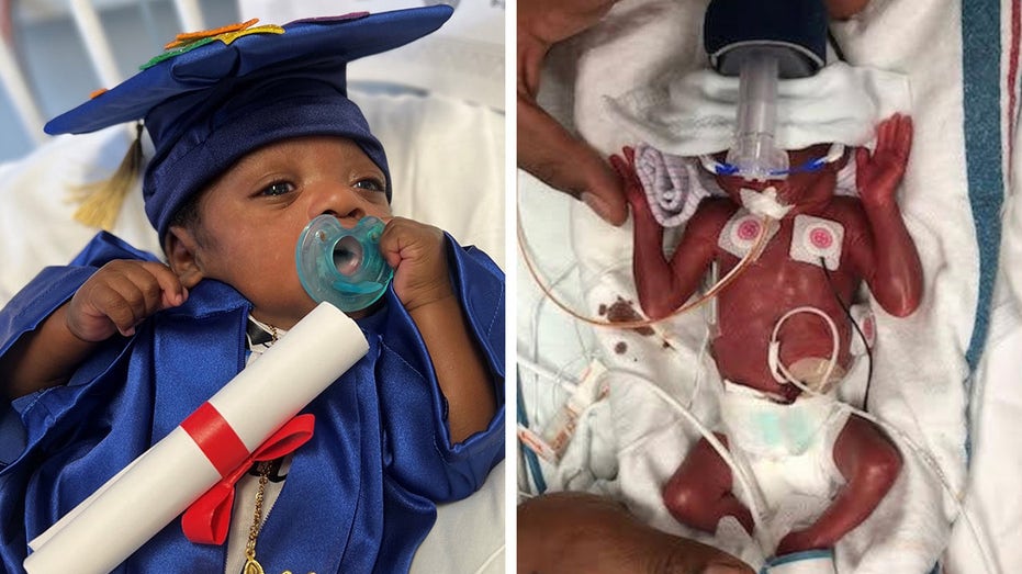 Micro-preemie born 'on the edge of viability' in Texas celebrates 1st birthday: 'Quite the survivor'